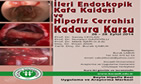 İleri Endoskopik Kafa Kaidesi ve Hipofiz Cerrahisi Kadavra Kursu